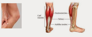 RESEP UNTUK KEJANG OTOT KAKI | JAMU OBAT TRADISIONAL