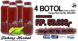 Langkah mudah untuk payudara bebas dari benjolan/kanker Langkah mudah untuk payudara bebas dari benjolan/kanker