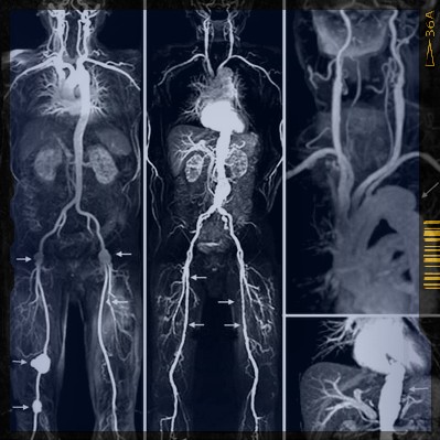 ct scan vs mri
