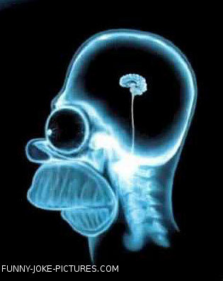 Funny X-Ray Photo Images Homer Simpson Funny X-Ray Photo Images Homer Simpson