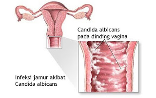 Menyempitkan Vagina Longgar Mujarab Menyempitkan Vagina Longgar Mujarab