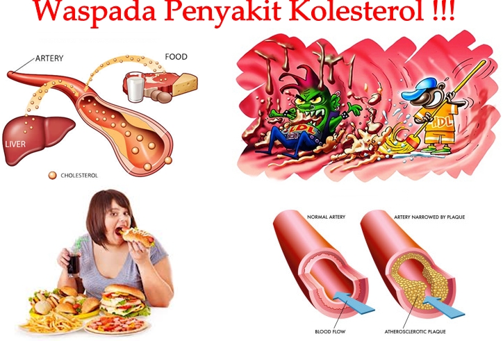 Pengobatan Alternatif Kolesterol Tradisional