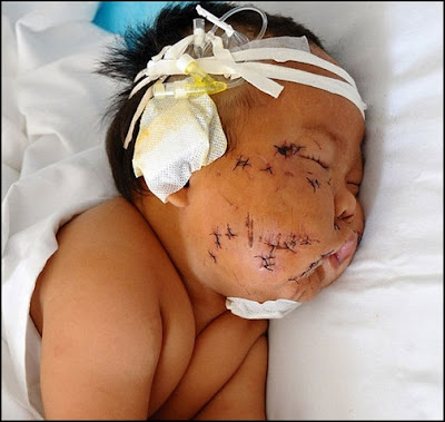 Um bebê de oito meses é agredido pela própria mãe na china. Saiba como e por quê da agressão.