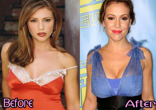 pornmade com dirty teens in alyssa milano breast enhancement