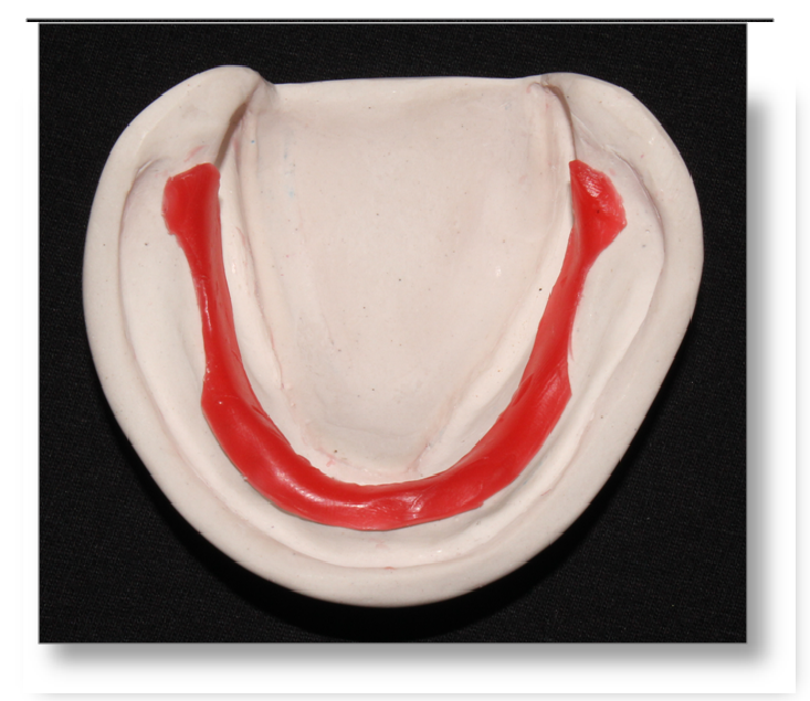 Step by step Guide for Understanding the Prosthodontics Complete