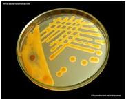 Chryseobacterium indologenes on Mueller-Hinton agar