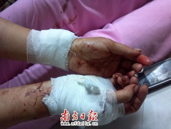 lelaki ditangkap polis kerana laporkan cubaan merogol Tangan wanita yang dicederakan dirawat sebaik saja diselamatkan polis