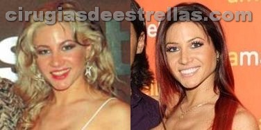 Antes y Después del bisturí,impresionante !! Antes y Después del bisturí,impresionante !!