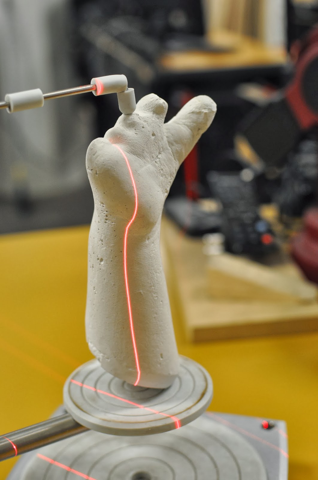 handverker shea's plaster cast scan