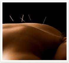 Port Moody Acupuncture