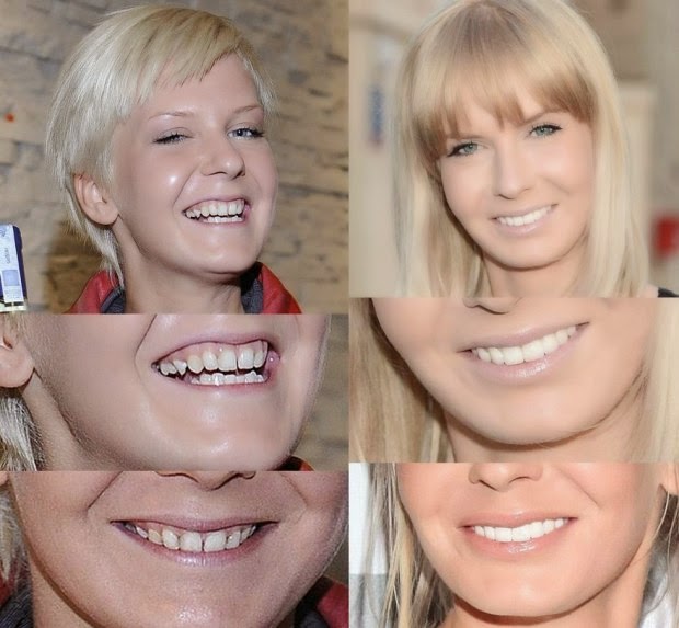 Odchudzanie Motywacja Radość: Czy każda kobieta może się upiększyć i