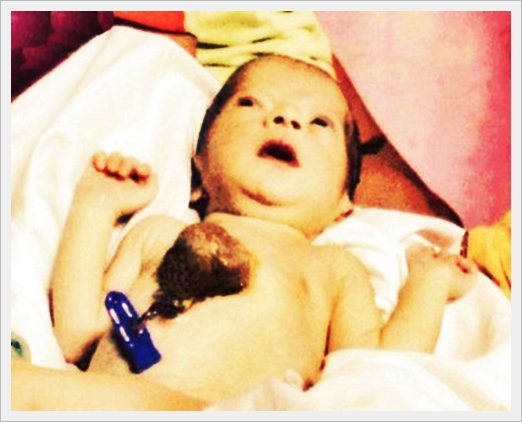 twenty2december™ : 10 Unusual Babies : Medical Conditions