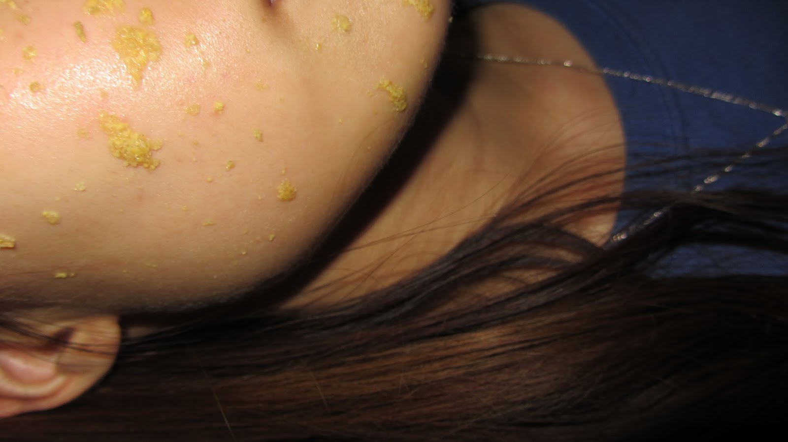 Cutetipps review DIY ♡ Fenugreek Mask (Easy) for Acne Prone Skin and