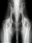 Example Hip Xray if you Google "Hip Dysplasia"