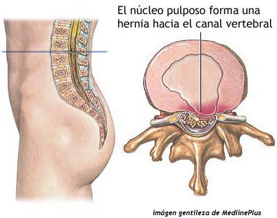 El dolor en la ingle a la izquierda a los hombres da en los riñones