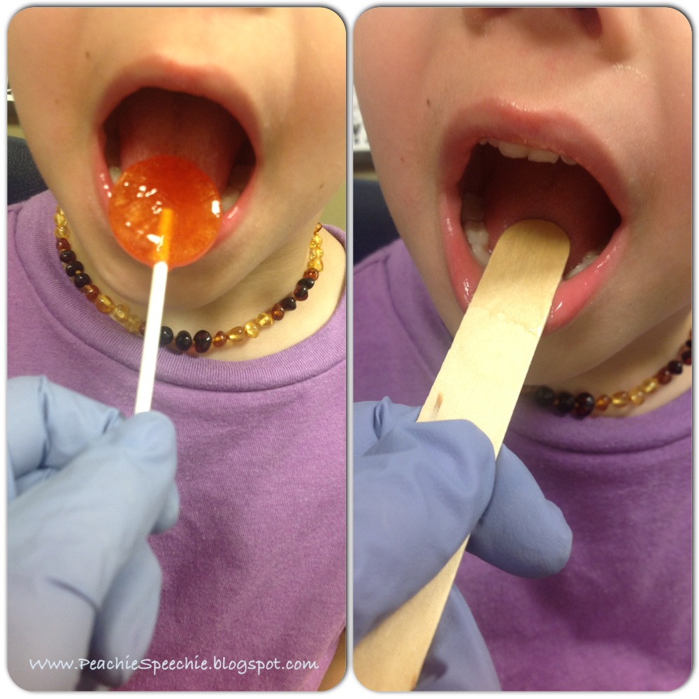 the peachie speechie Eliciting /k/ and /g/