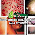 Obat Penyakit Sipilis De Nature Indonesia