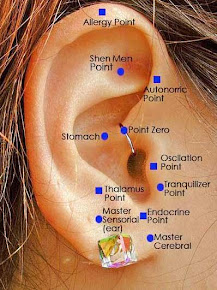 AURILOCUPUNTURA