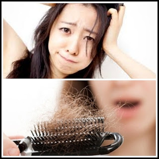 5 Causes and 2 way cope with hair loss 5 Causes and 2 way cope with hair loss