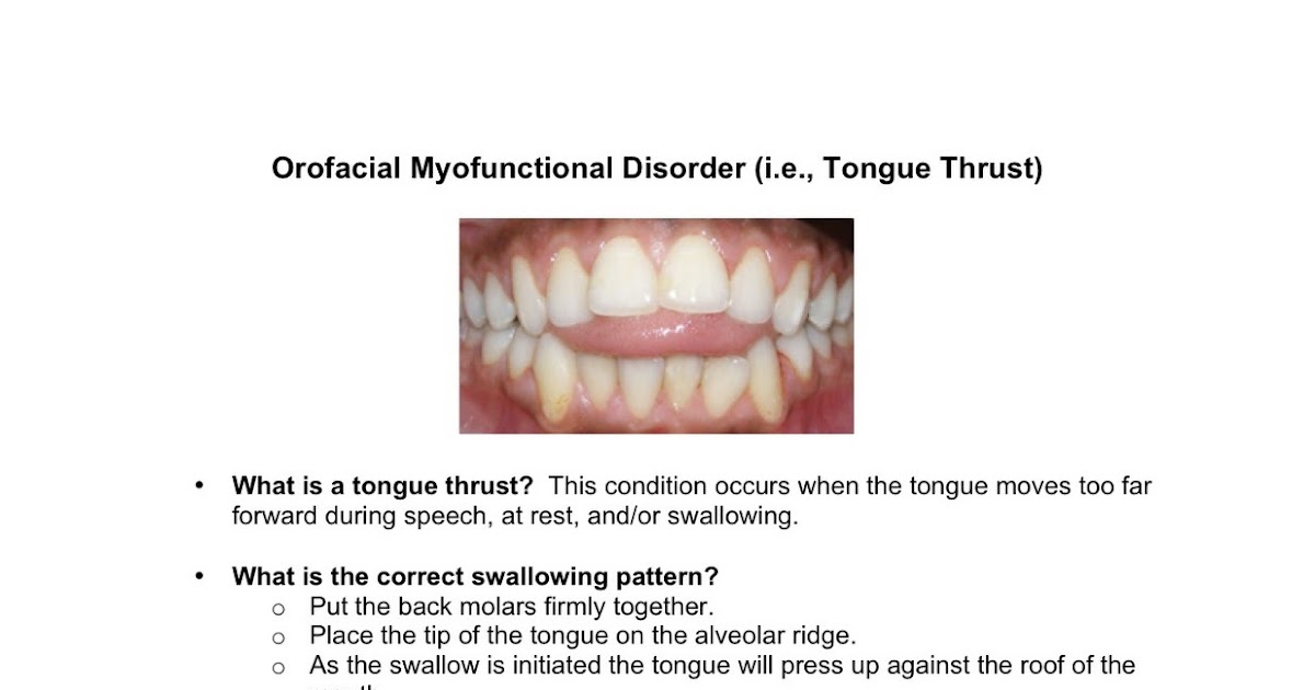 Clear Speech Therapy Tongue Thrust