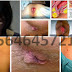 Obat Anus Keluar Darah di Apotik thumbnail