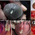 Penis Sakit Saat Kencing dan Bernanah Penyakit Apa thumbnail