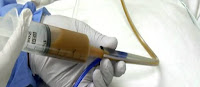 Fuente: http://www.monografias.com/trabajos100/trasplante-fecal-obesidad-y-psiquiatria-a-entidades-paralelas/trasplante-fecal-obesidad-y-psiquiatria-a-entidades-paralelas.shtml#hormonasea