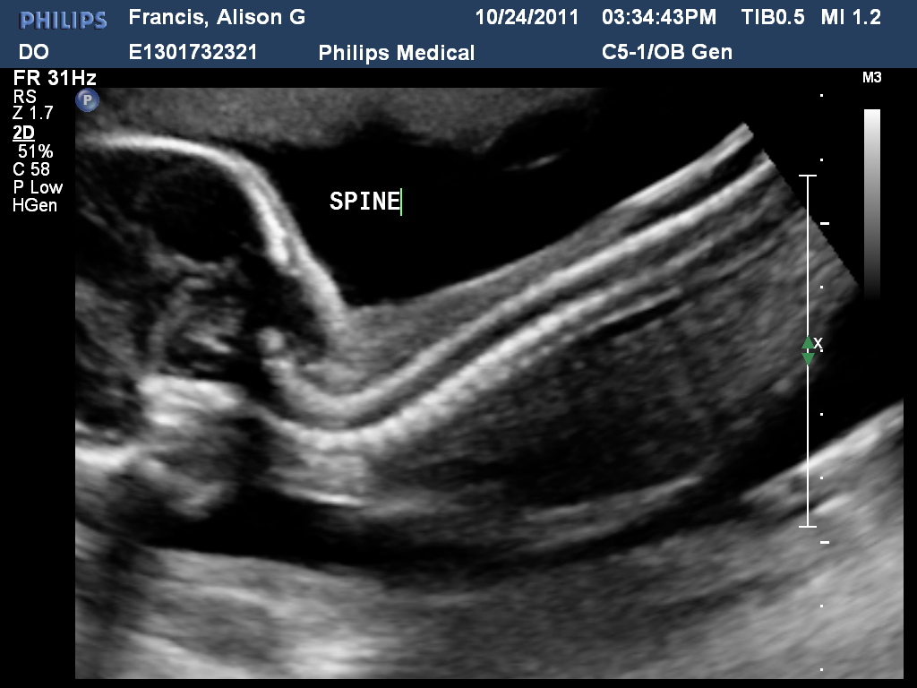 Francis Family Fun: Baby Boy!