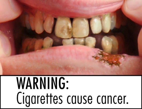 Image result for smoking causes cancer  blogspot.com