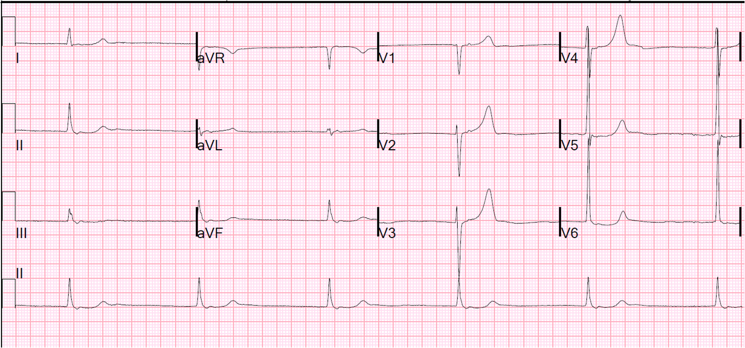 Heart Cardia Emergency Room Heart Cardia Emergency Room