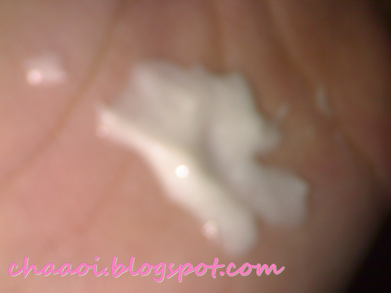 Clogged Pore Nose