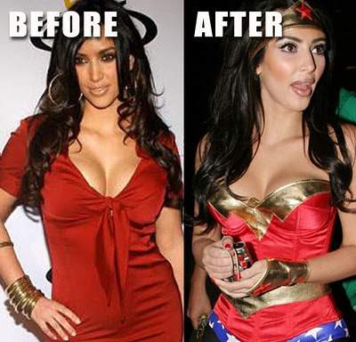 Myriam Fares Plastic Surgery on Kim Kardashian Before And After Plastic Surgery