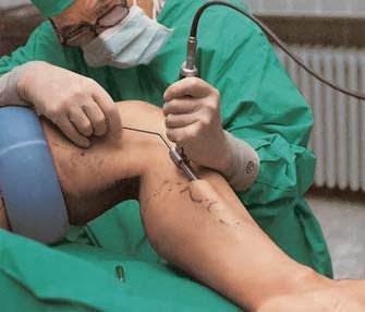 Los medios públicos que untar las venas en los pies