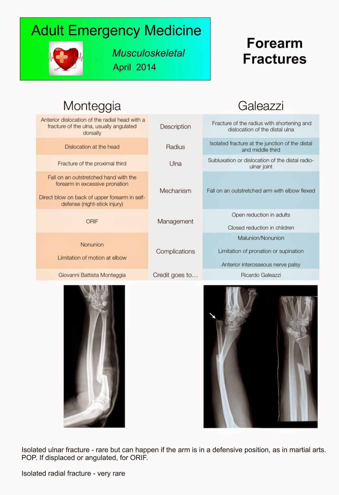 Musculoskeletal Emergency Medicine Forearm Fractures