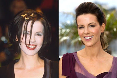 cambio sonrisa actrices famosas