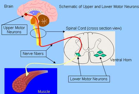 Neurosurgeon-Bangalore: June 2013