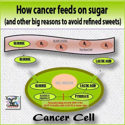 http://4.bp.blogspot.com/-3VXttEt46Tc/UNcQVAmGayI/AAAAAAAAOCE/M2bUewT4gqs/s400/Sugar%2Bcancer%2Bcells.jpg