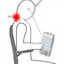 Mobile User Health Warning: Wireless usage linked to Kyphotechnosis