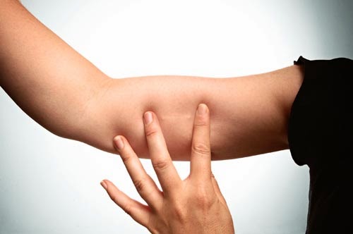 Deri Alti Cubuk Implant Nedir Kadin Ve Yasam