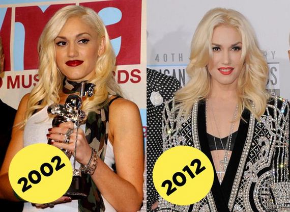 [ Myriad Pictures ] Celebrities Who Never Age