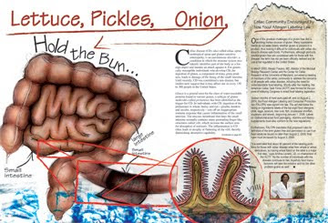 Gluten free diet in celiac disease