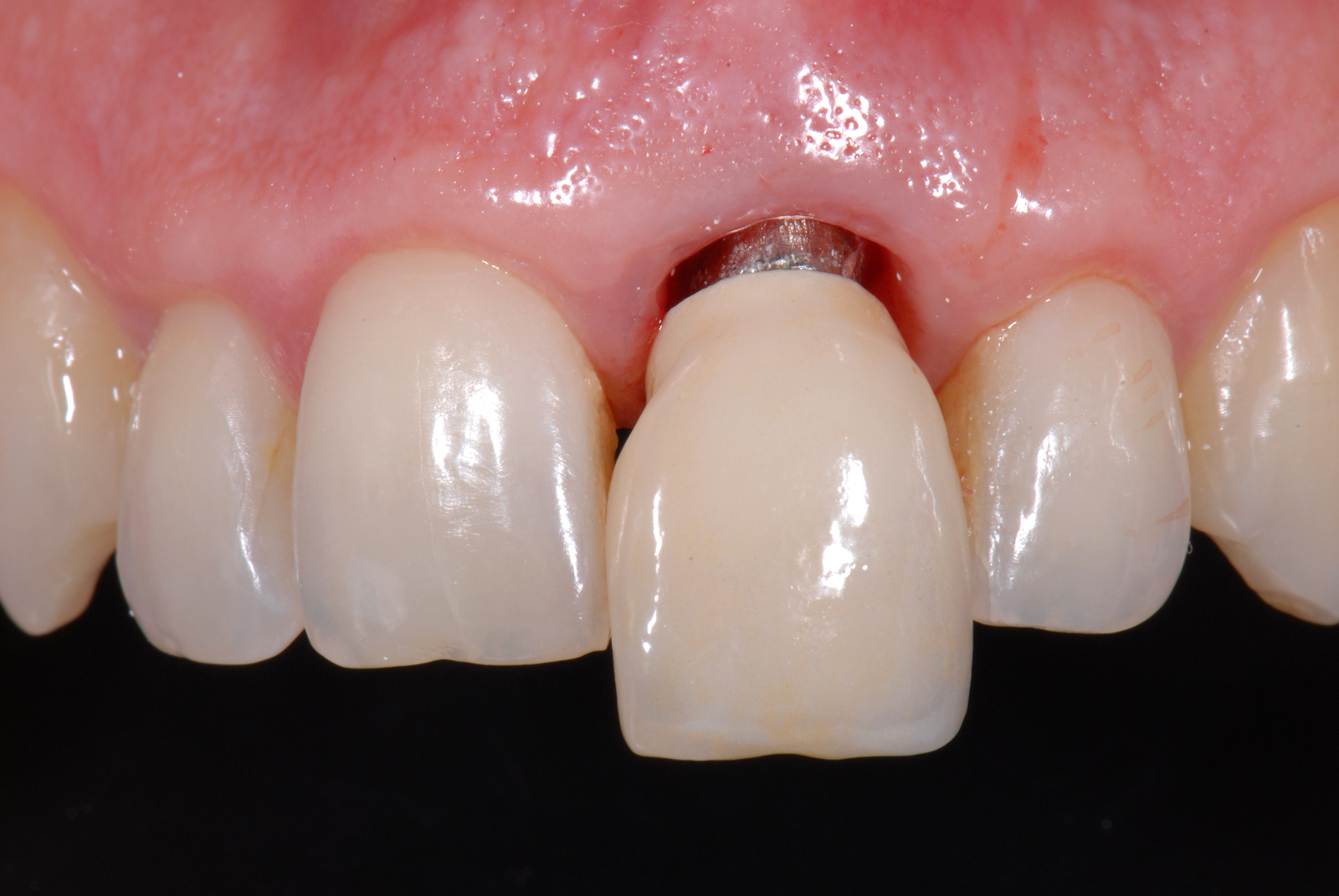 Dental Photography Pearls For Better Images Instantly An easy (and