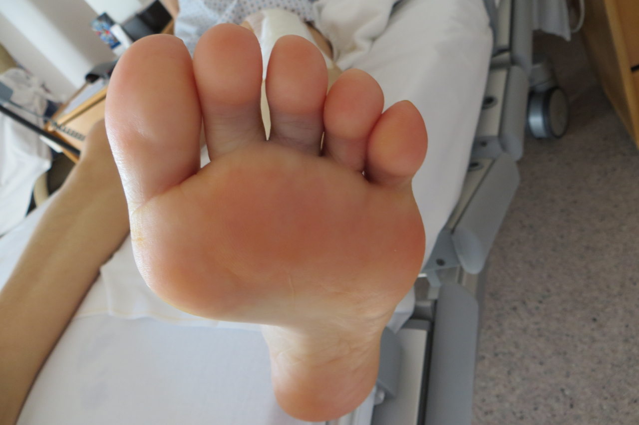 dessus de pied enfle dessus de pied enfle