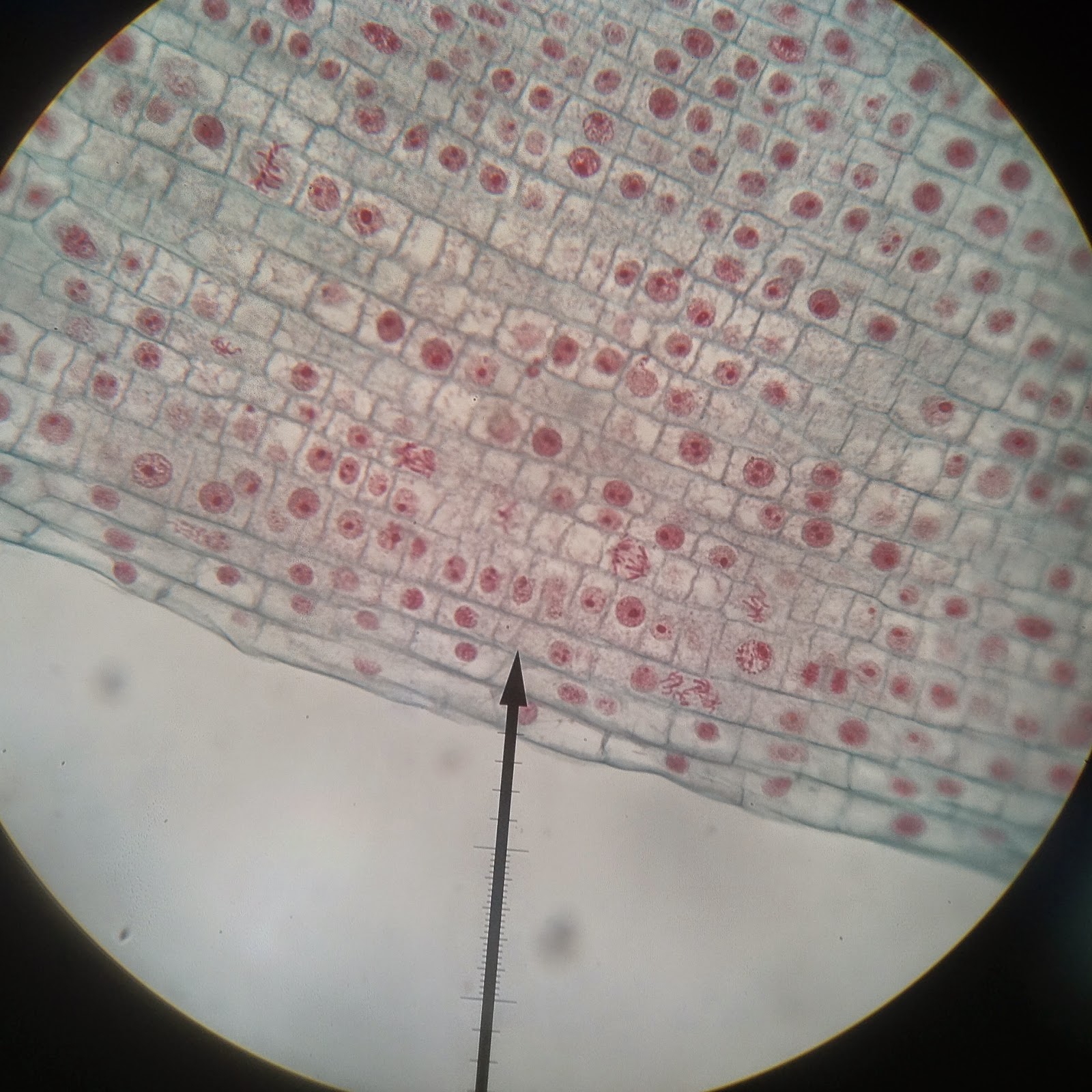 Mitosis Lab Biology Honors Blog