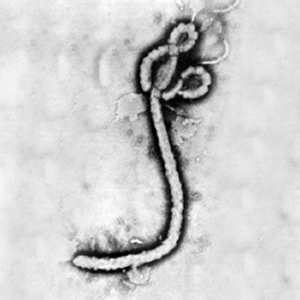 Ebola_virus_1.jpg