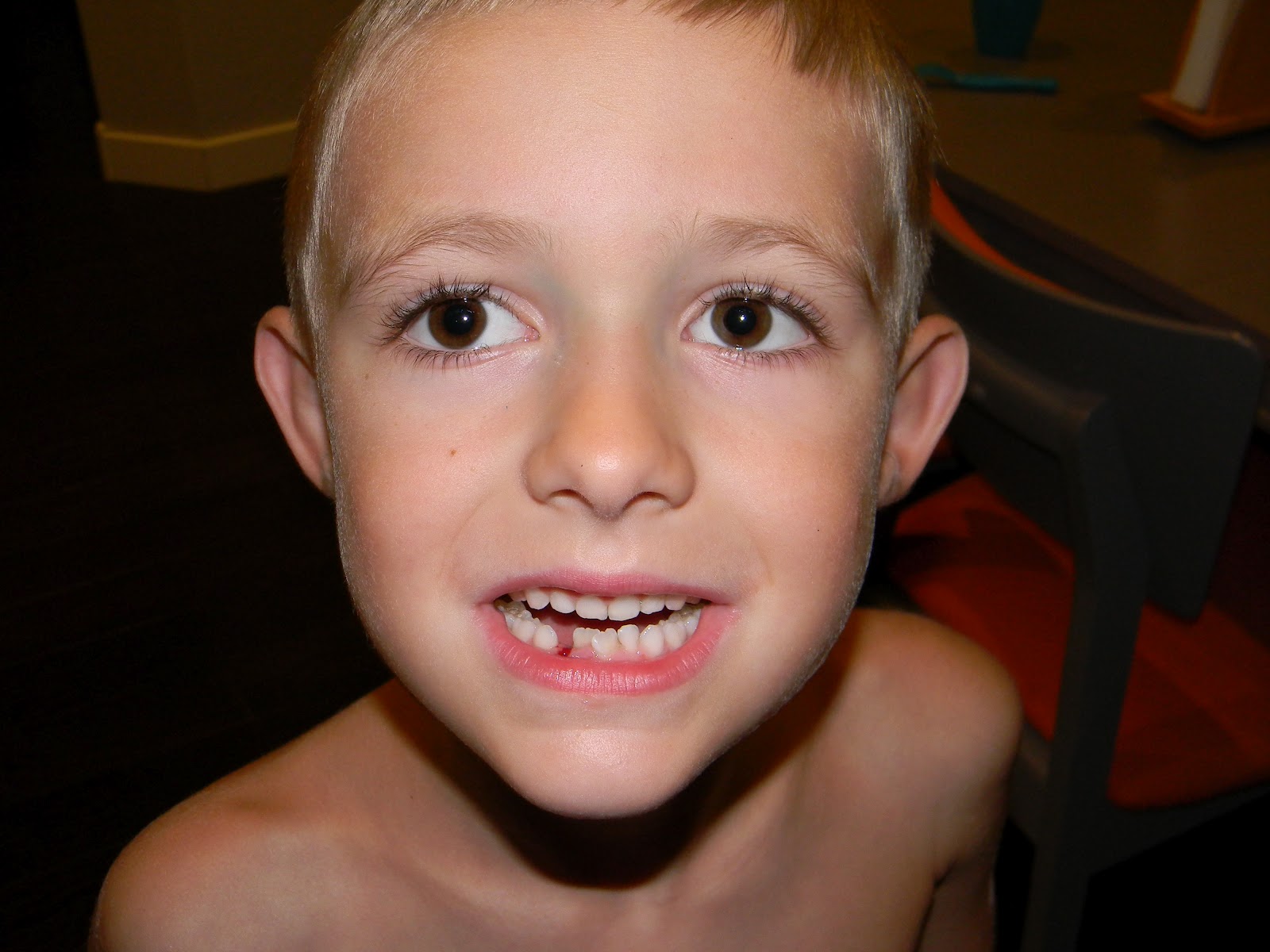 Braces On Kids