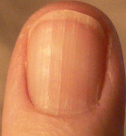 health nails article 2012