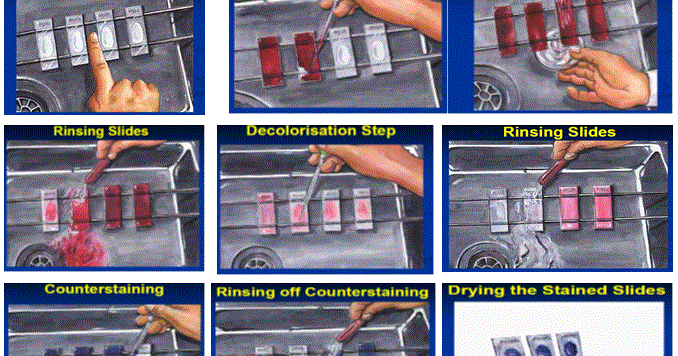 Dunia Kesehatan Pewarnaan Bta