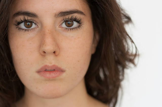 Se la mesotherapy da posti di pigmentary aiuta su