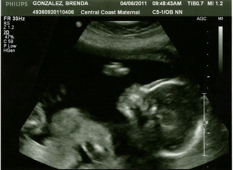 Our Little Corner ♥ baby update 22 weeks